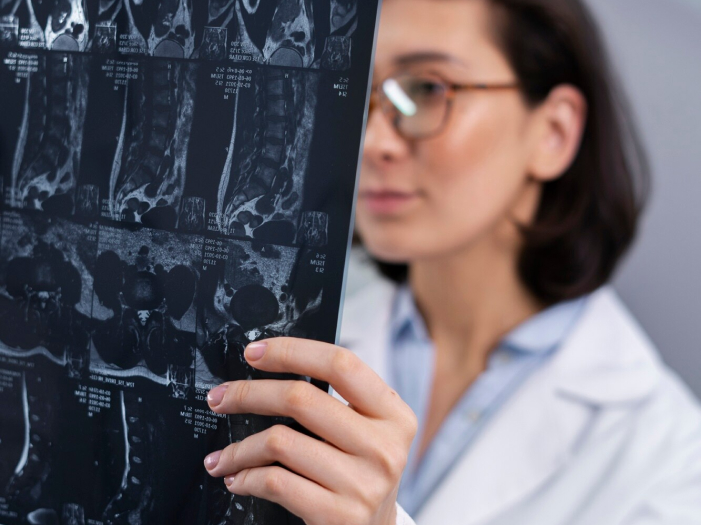 Profesional médica examinando imágenes de resonancia magnética o tomografía