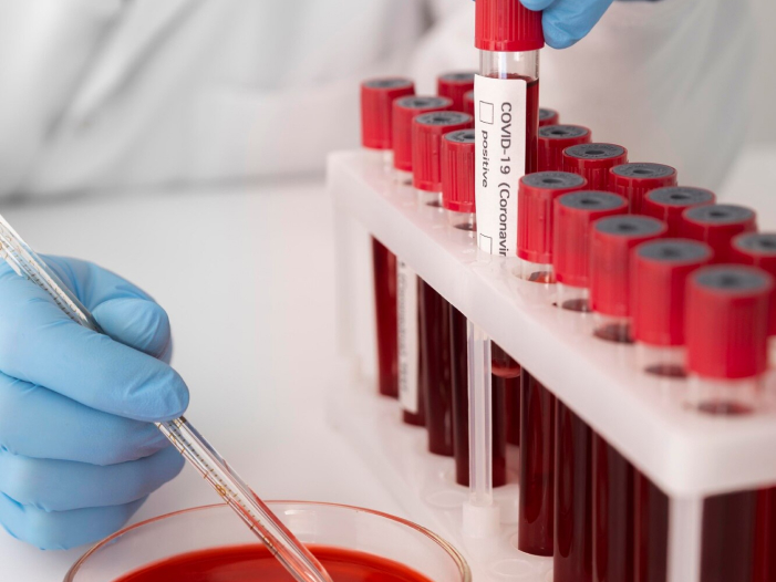 Investigador en laboratorio etiquetando tubos de ensayo con resultados positivos de COVID-19